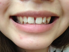 �O���̂��������@�摜