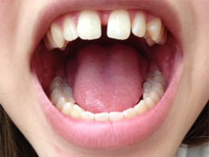 �O���̂��������@�摜