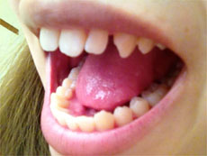 �O���̂��������@�摜