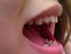 �O���̂��������@�摜