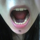 �O���̂��������@�摜